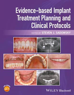 Read Online Evidence-Based Implant Treatment Planning and Clinical Protocols - Steven J. Sadowsky | PDF