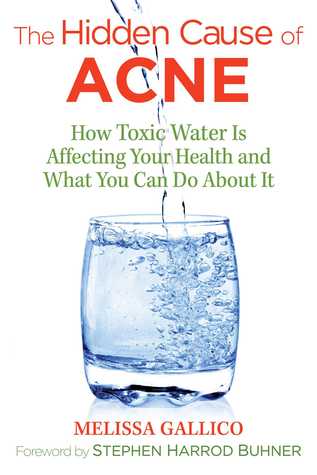 Read The Hidden Cause of Acne: How Toxic Water Is Affecting Your Health and What You Can Do about It - Melissa Gallico file in ePub